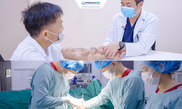Biến dạng cánh tay sau 11 năm chạy thận: PhenikaaMec bảo tồn thành công cầu nối AVF
