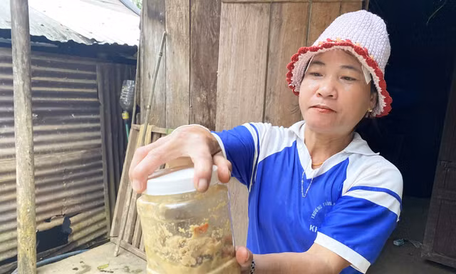 Hé lộ nguyên nhân món cá ủ chua khiến 3 trẻ ở Đà Nẵng nguy kịch phải nhờ sự trợ giúp từ WHO 