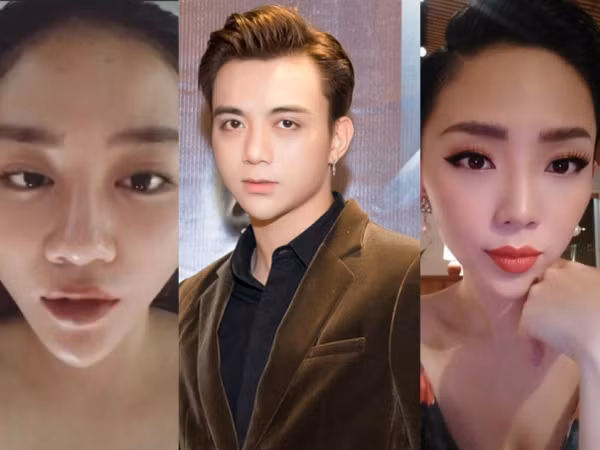 Sao nam, nữ Việt chạy đua mốt mặt với cằm nhọn "đâm thủng giấy"