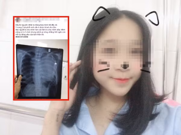 Tâm sự của cô gái 22 tuổi nghi bị ung thư phổi là lời nhắn khiến giới trẻ "lặng người"