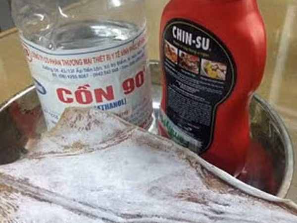 Một teen ở Hà Nội bị bỏng nặng do nướng cá mực bằng cồn