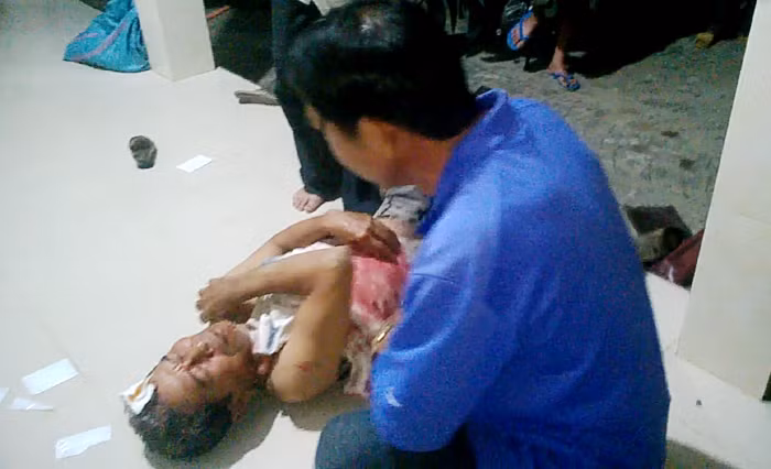 Nạn nhân Hoàng Trọng Niệm bị đối tượng 'cát tặc' Hoàng Trọng Trị chém trọng thương 