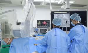 Cảnh báo, nhiều người trẻ mắc bệnh rung nhĩ, nguy cơ đột quỵ tăng gấp 5 lần