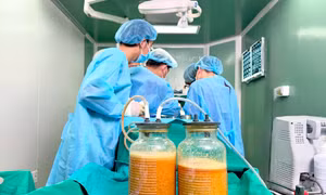 Bác sĩ lấy ra gần 5 lít dịch và 'chất lạ' trong ngực nữ bệnh nhân