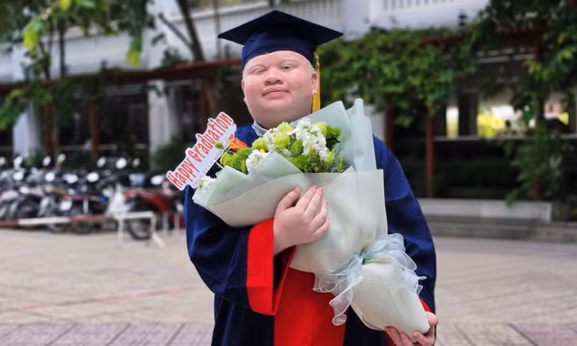 Nghị lực của chàng trai bạch tạng tốt nghiệp loại Giỏi ngành Sư phạm Toán 